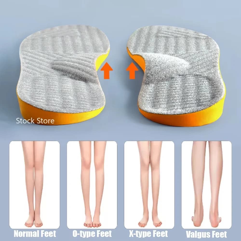 새로운 아치 지원 신발 용 플랫 발 정형 안창 여성 남성 어린이 X/O 유형 다리 Valgus 발 교정 스포츠 신발 패드